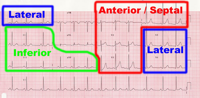 ecg-zones